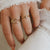 Reta-Ring 